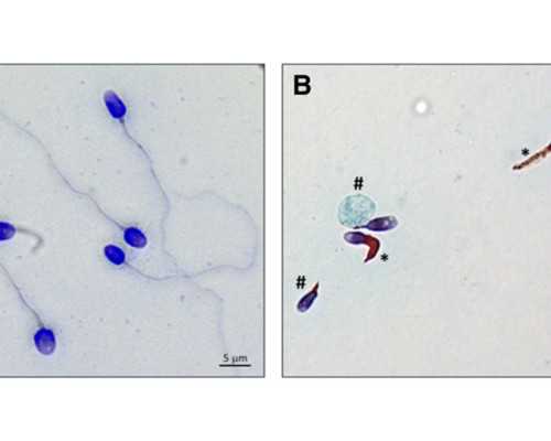 深圳咨询服务公司_广州贝秀|2024湖州供卵试管医院排名前十已更新！内附供卵包